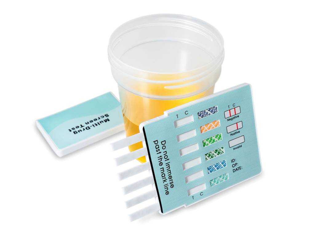 Urinbecher mit Multi-Drogentest als Symbol für Drogentest am Arbeitsplatz